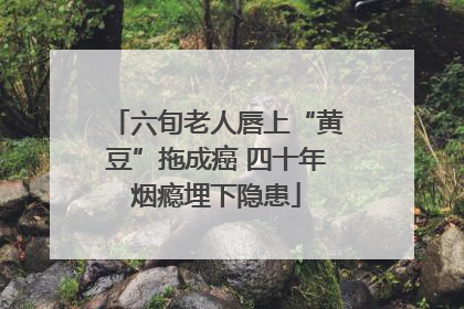 六旬老人唇上“黄豆”拖成癌 四十年烟瘾埋下隐患